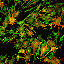 An image of Schwann cells and myelin proteins.