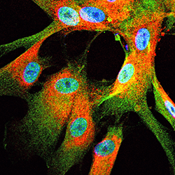 An image highlighting TAZ/YAP in human nerve tumors.