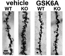 One image showing an excess of synaptic structures in mice.