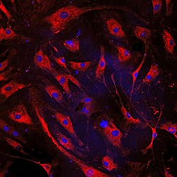 A microscopic image showing treated human heart failure cells.