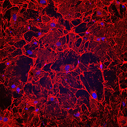 A microscopic image showing untreated human heart failure cells.