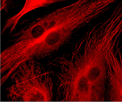 Pulmonary cells.