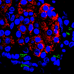 Human pancreatic tissue.