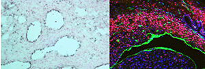 Endothelial cells and blood vessel endothelium.