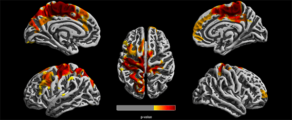 Brain images of 12-year-old children.