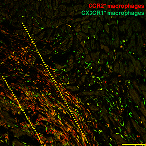 A microscopic histology image of macrophage immune cells.