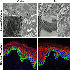 Microscopic images of human epidermis with pluripotent stem cells derived from donated skin cells.