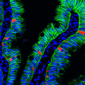 An image of a human intestinal organoid.