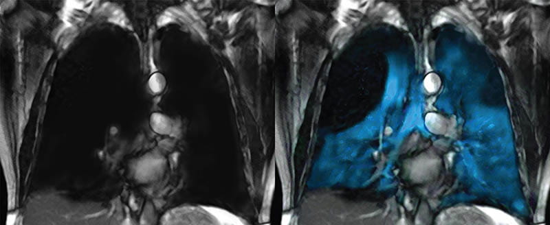 Images of a Proton MRI Scan (left) and Xe MRI Scan (right).