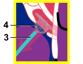 tasdc_2_2