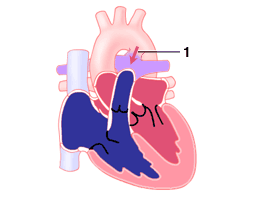 pda_1_2