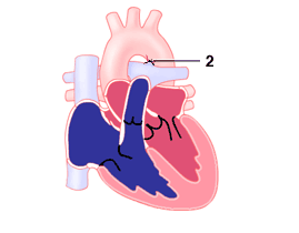 pda_2_2