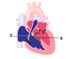 tet_2_2