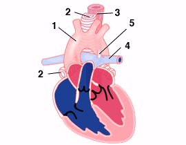 vascularrings_1_1
