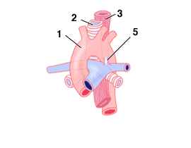 vascularrings_1_2