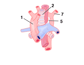 vascularrings_3_2