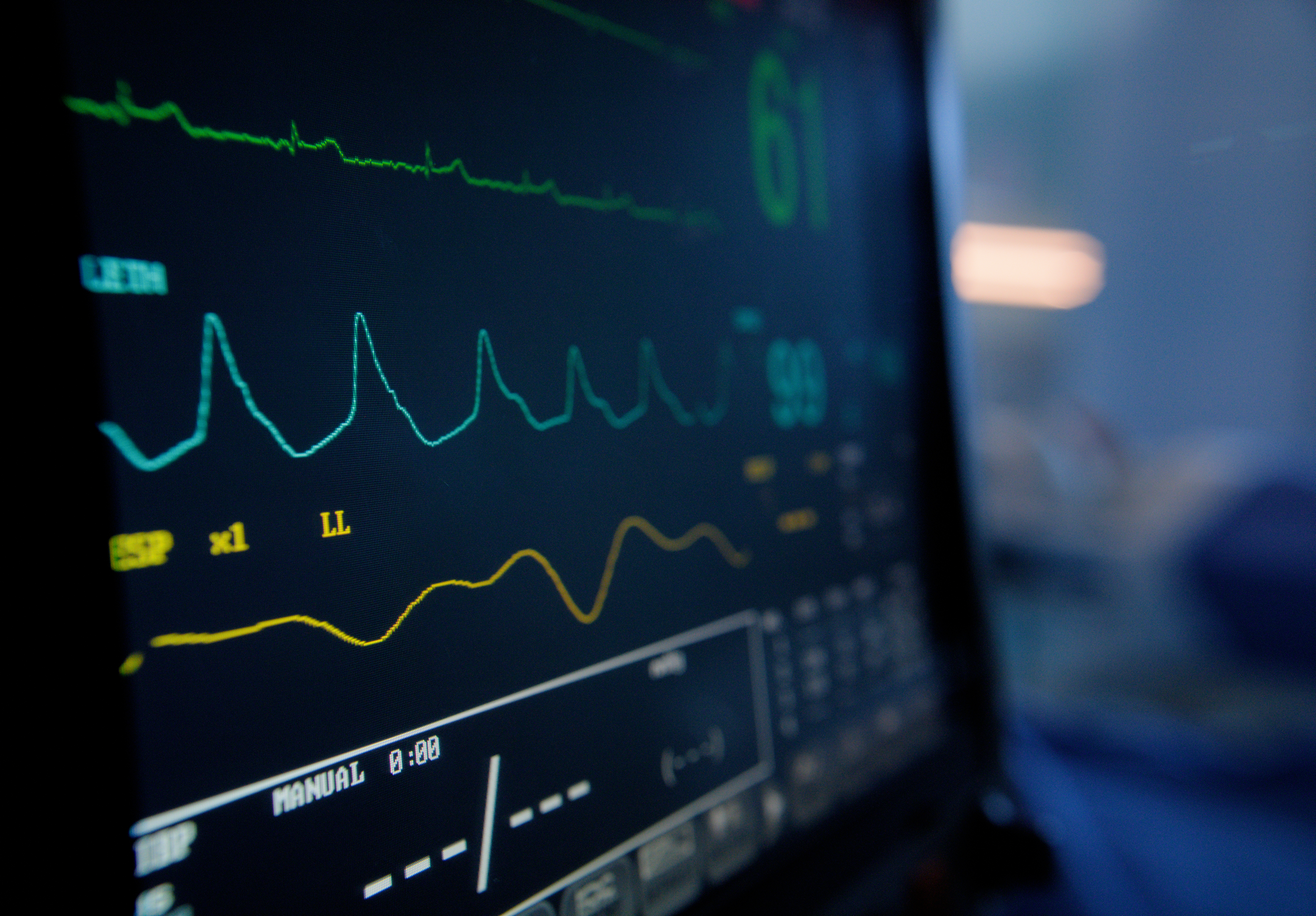 A photo of an ECG.