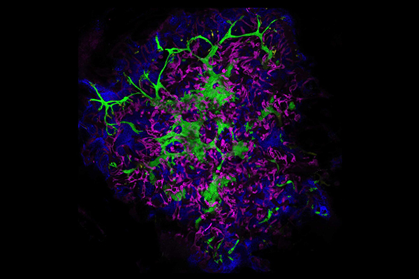 Human kidney assembloid derived from stem cells.