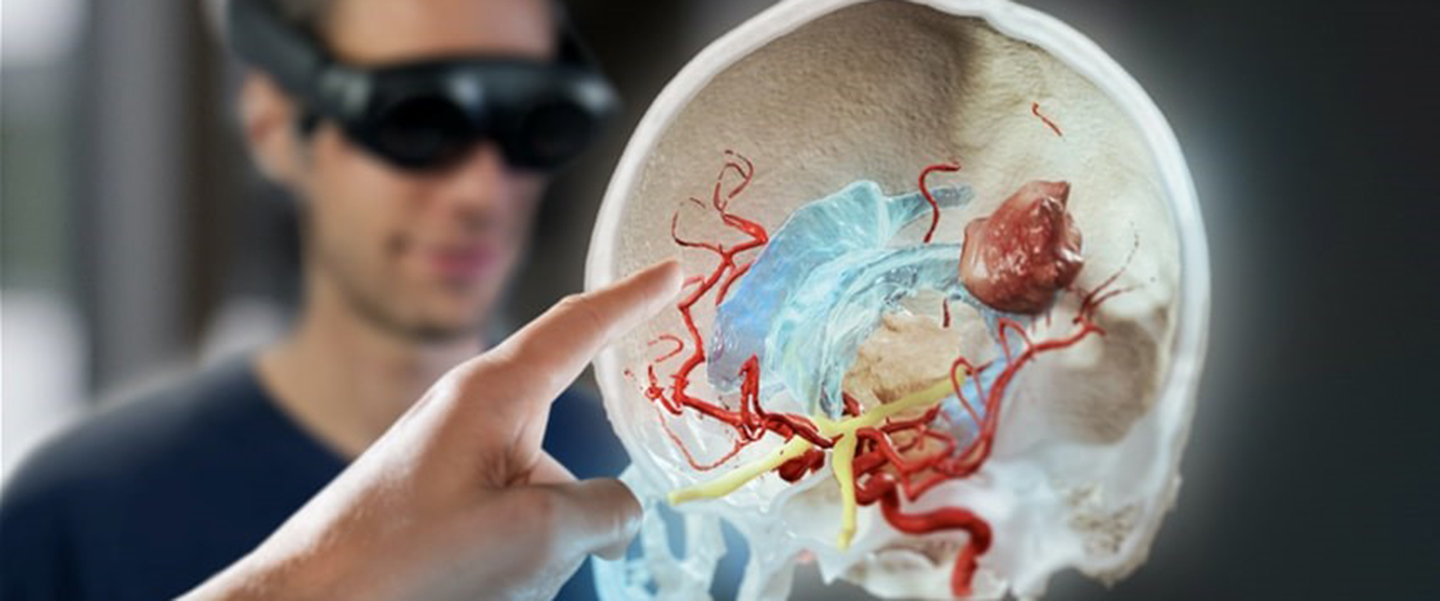 An image of anatomical structures that can be seen with the Mixed Reality Viewer.