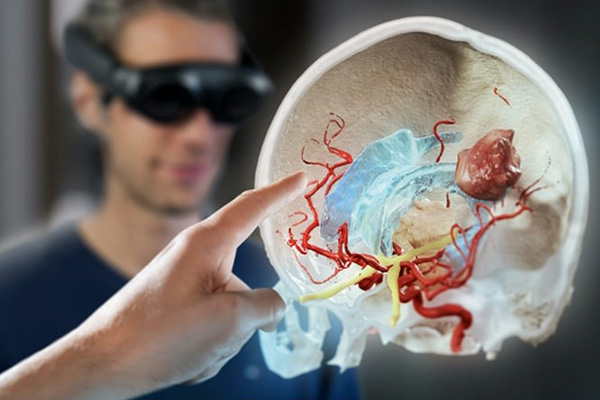 An image of anatomical structures that can be seen with the Mixed Reality Viewer.