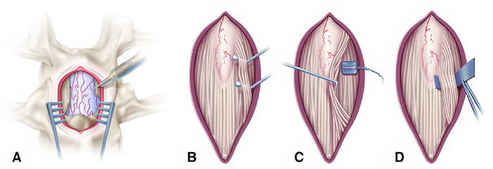 Illustrations depicting the procedure.