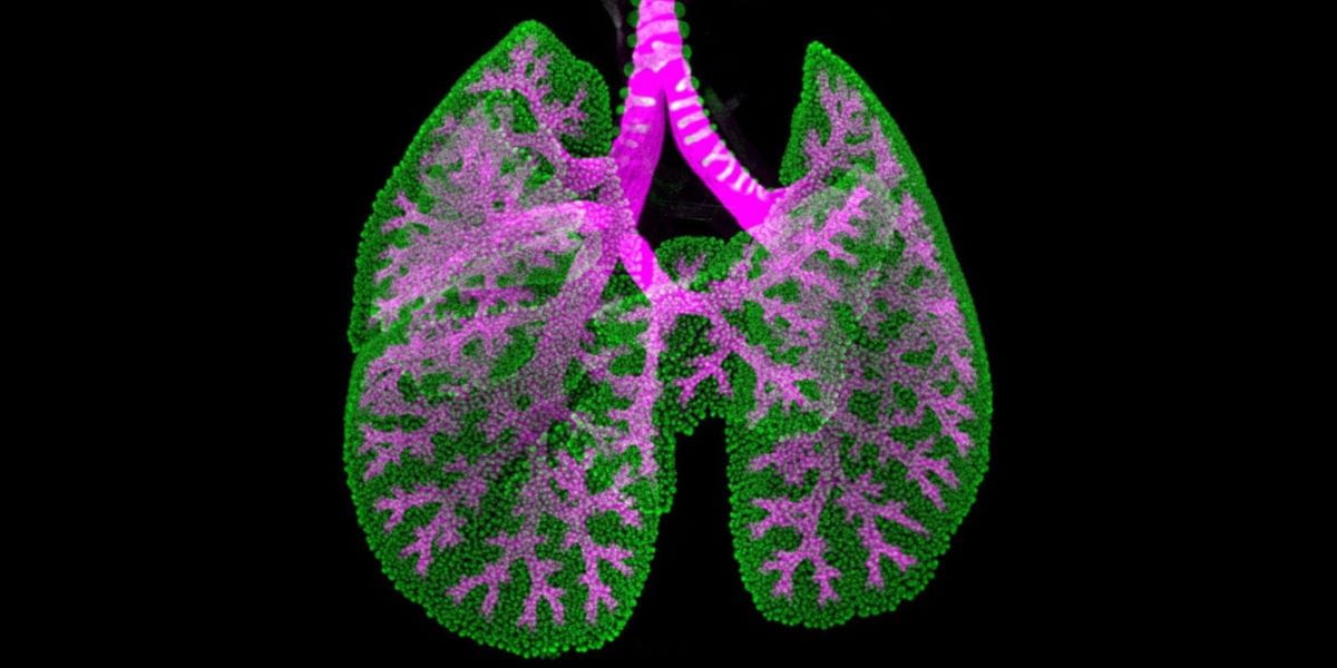 Computer image of lungs.