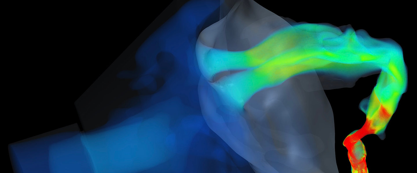 Image from airway modeling.