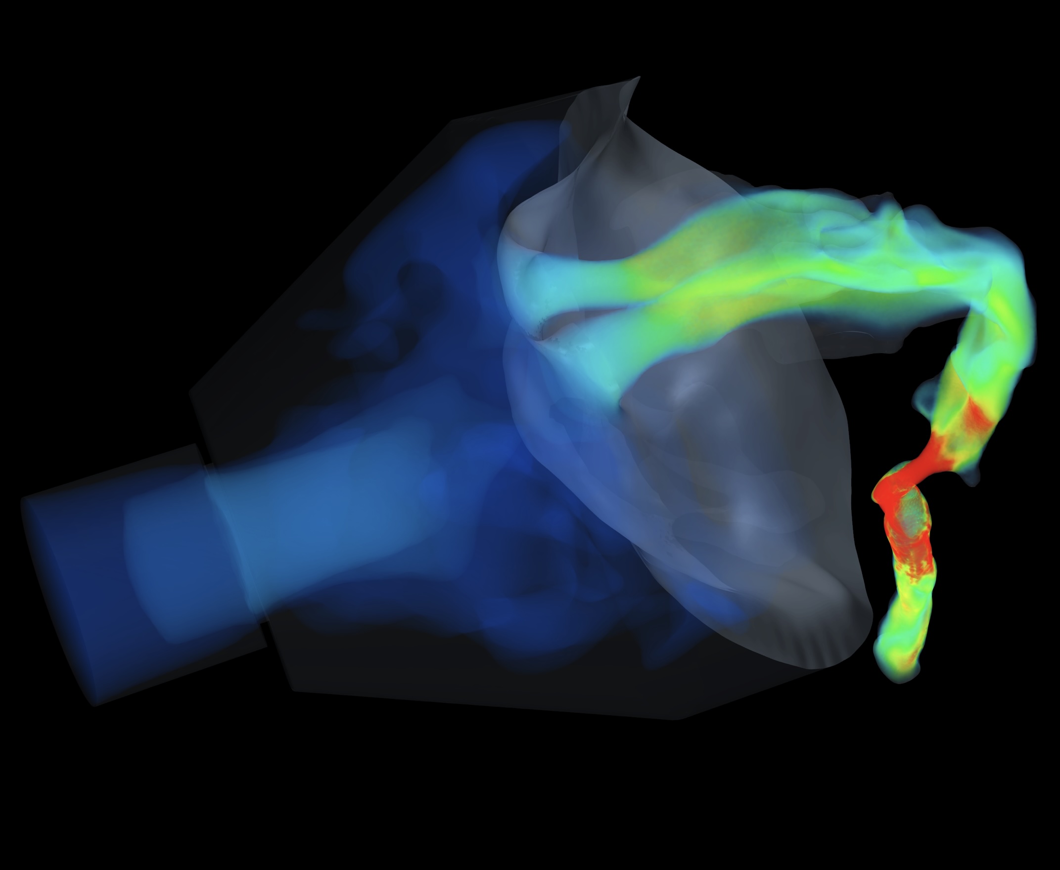Image from airway modeling.