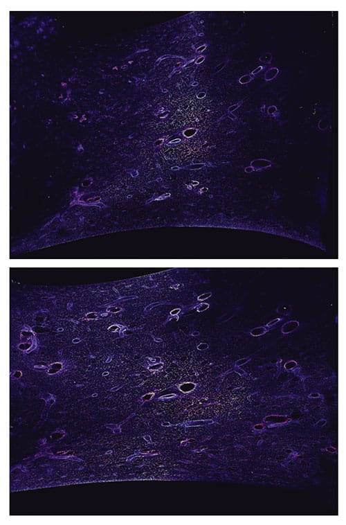 Fig A: These before and after images of postnatal lung development in mice illustrate how Cela1 binding and elastase activity increased with stretch.