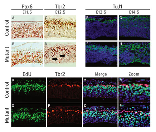 Fig A:  Because the brain is particularly sensitive to changes in cholesterol metabolism, researchers focused on understanding the mechanisms behind enzyme deficiencies. These images show how neural progenitor and differentiated neuron populations are altered in the Hsd17b7   rudolph mutant mouse brain cortex. Images (A) and (B) show Pax6 apical progenitors at E11.5, and (C) and (D) show Tbr2 intermediate progenitors at E12.5. Post-mitotic populations are shown in the control and mutant at both E12.5 (E and F) and E14.5 (G and H). Scientists used double-immunostaining for EdU (K and O) and Tbr2 (L and P) at E11.5 to show increased double-positive cells in the mutant (Q and R) compared to the control (M and N). This indicates a premature differentiation program in the mutant brain.