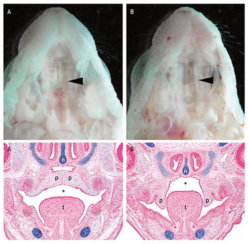Fig A:  The Golgi-associated Golgb1 protein is required for normal palate development. In oral views, arrowheads show a cleft palate in the Golgb1 mutant mouse pup (B) in comparison with the closed palate in the normal littermate (A). Frontal sections of each mouse reveal failure of palatal morphogenesis in the Golgb1 mutant embryo.