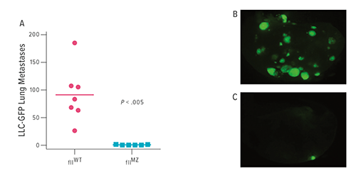 These images show diminished experimental tumor metastasis in fIIMZ animals. Cohorts of fIIWT and fIIMZ animals were challenged with lung cancer cells expressing green fluorescent protein. Two weeks later, metastatic foci in the lung were determined. A substantial, statistically significant diminution in the number of lung metastases was noted in the fIIMZ animals compared with fIIWT mice (A). FIIWT animals had prominent metastatic foci (B), whereas many fIIMZ animals demonstrated few, if any, metastases (C).
