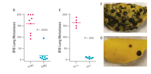 Cohorts of fIIWT and fIIMZ animals were challenged with IV bolus of B16 melanoma. Eighteen days later, metastatic foci in the lung were determined. As was seen with LLC, fIIMZ animals had significantly fewer metastatic foci when compared with fIIWT mice (D). The same pattern was found when comparing fIIWT mice with mice with 50% prothrombin (fII+/-) (E). Numerous metastatic foci were seen in fIIWT animals (F), whereas metastases were rare in fIIMZ mice (G).