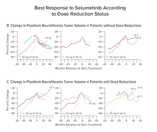 Panels B and C show the change in plexiform neurofibroma volumes before (when available) and after initiation of treatment with selumetinib among patients who did not have dose reductions (Panel B) and among those who had dose reductions (Panel C) during the trial. Separate graphs are presented for the three dose levels (20, 25, and 30 mg per square meter of body surface area), with selected patients highlighted.
