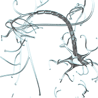 An illustration of nerve fibers.