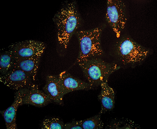 This micrograph shows human lung epithelial cells treated with RCM-1. This small-molecule compound prevents the transcription factor called FOXM1 (shown in yellow) from entering cell nuclei (blue). FOXM1 triggers excess inflammation and mucus in asthma, cystic fibrosis and chronic obstructive pulmonary disease.