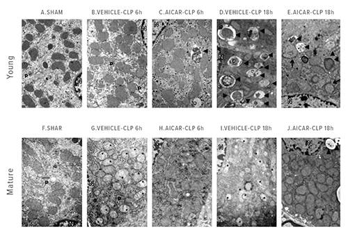 This photo shows transmission electron microscopy (TEM) images.