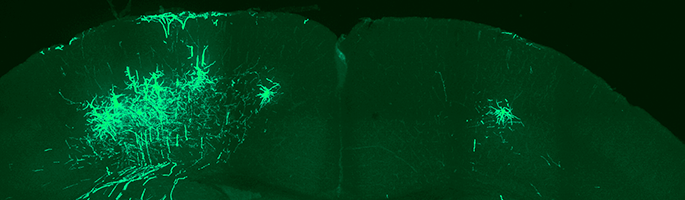 An image showing the coronal region of a mutant PlexA1 mouse.