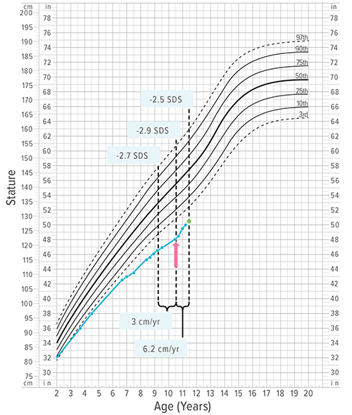 An image showing the point of accelerated growth following treatment with an experimental therapy.
