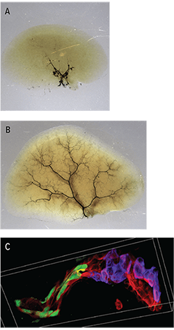 Three images related to liver regeneration.