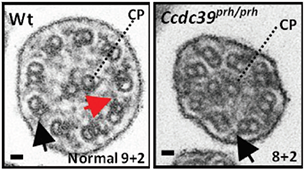 An image showing disorganized microtubule structure of ependymal cilia.