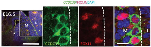 An image showing scattered expression of Ccdc39 in developing ependymal cells in the embryonic mouse brain.