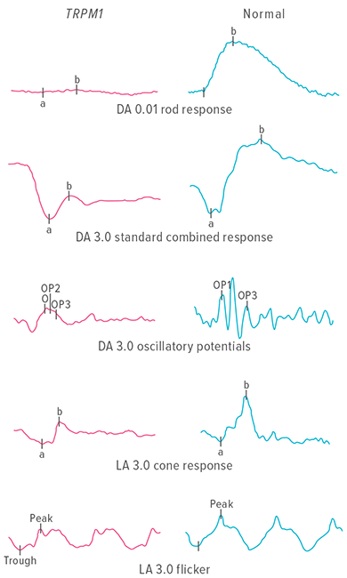 An image showing full-field electroretinography (ERG) waveforms.