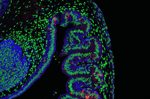 A microscopic image of human gastric organoids (hGOs).