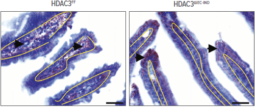 Images showing fat droplets (stained red) in intestinal epithelial cells.