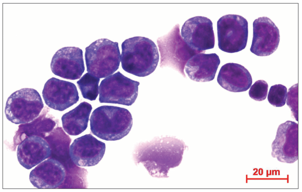 An image showing MLL-AF9 leukemia cells.