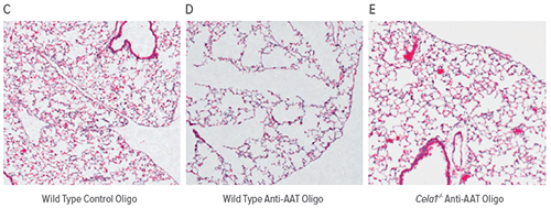 An image of lung tissue slides.