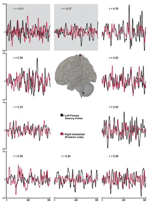 An image comparing motor-control function and injury risk.