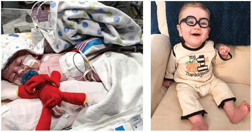 An image of the smallest ventricular assist device (VAD) patient ever.