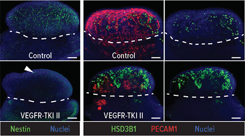 An image showing how vascularization affects fetal testis development.